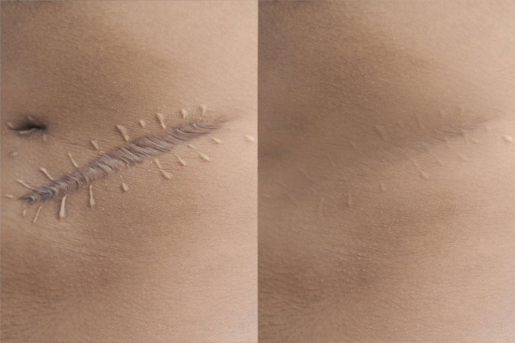 Medirval persona con cicatrices