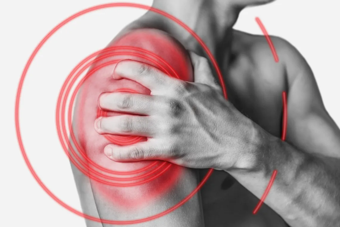 Tendinitis de hombro. ¿Qué es? ¿Por qué me duele?